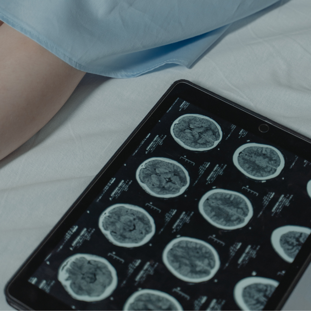 CT Scan Result on Digital Tablet